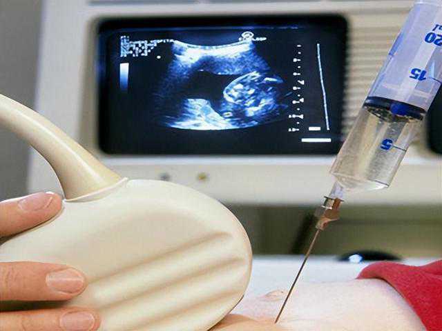 长沙公立医院供卵试管婴儿费用多少钱？明细拆解
